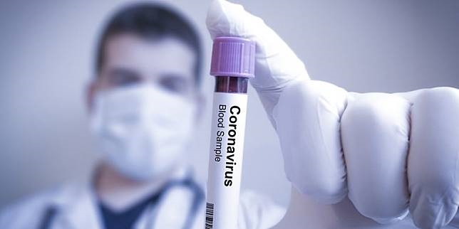 Virus Corona